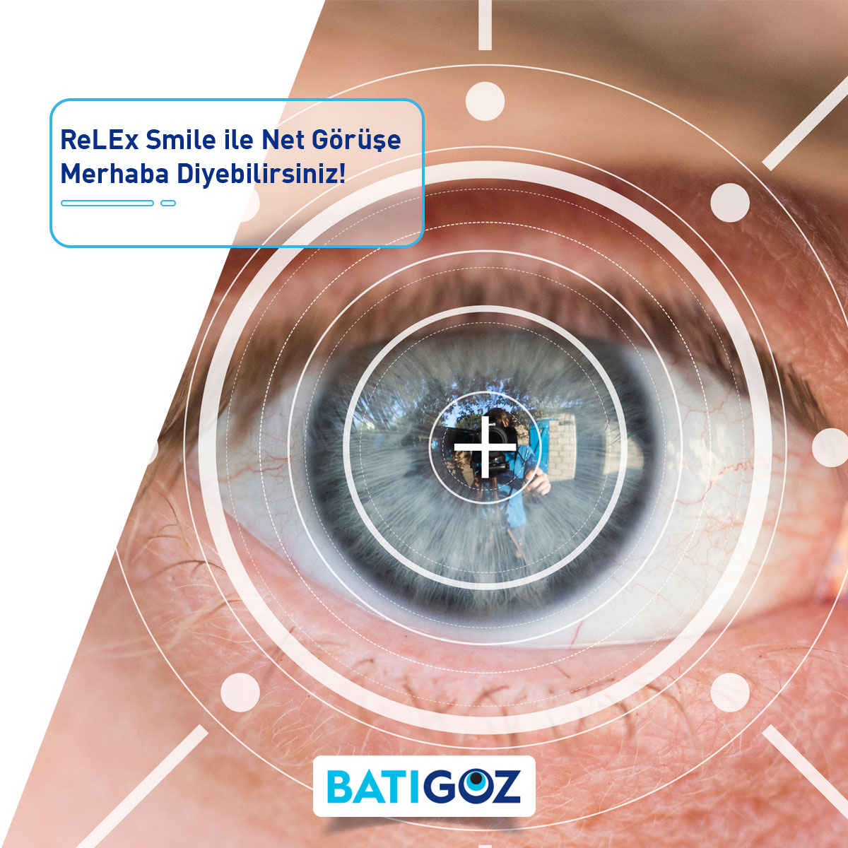 Batigoz's tweet photo. Güvenli ve etkili bir lazer tedavisi olan ReLEx SMILE miyop ve astigmat tedavilerinde sıklıkla tercih edilmektedir.
Detaylı bilgi ve randevu için hemen bize ulaşın.
🌐Online Randevu: https://t.co/MrweqjeX1e
☎Hemen Arayın: 444 23 24
#Batıgöz #gözsagligi #ReLExSMILE https://t.co/OUGExsihZH