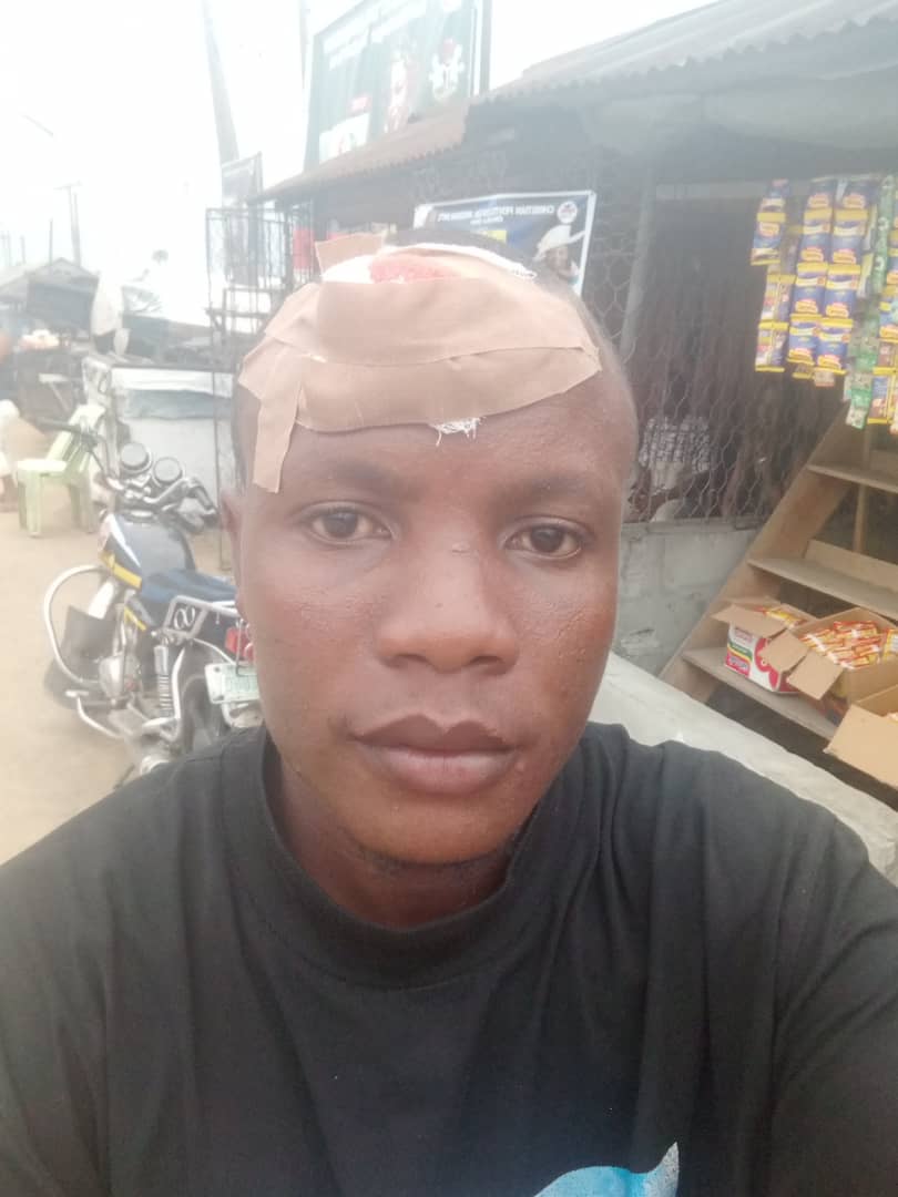 HWokocha's tweet photo. Rivers Of Blood! 😭😭😭

In the process of defending our Votes at the 5 units in his community Ward 4, PDP thugs brutality injured Him and took away the Materials to unknown destination..
@inecnigeria  @MBuhari @BBCBreaking  @ARISEtv  @cnnbrk
#PrayforRivers  #RiversDecide2023 https://t.co/PvU0TCc22P