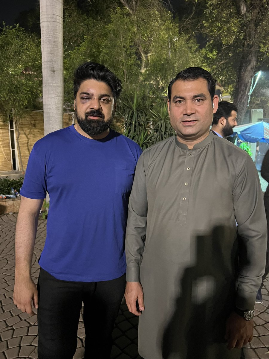 UmrPTI's tweet photo. عمران خان کا ٹائیگر عمر سلطان جس کو کل بُری طرح پیٹا گیا۔
ناک کی ہڈی تُڑوانے کے بعد بھی آج زمان پارک میں عمران خان کی حفاظت پر موجود ۔👍
اس جذبے کو کیسے شکست دو گے ؟
#زمان_پارک_پهنچو https://t.co/j86VQWklQY