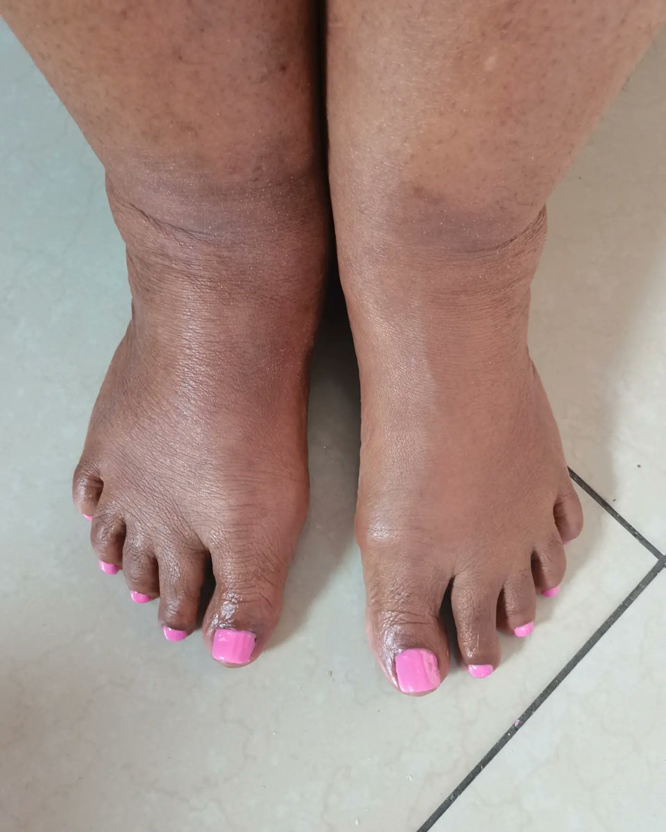 buffer_beauty's tweet photo. Pink toes💓💓💓

#Bufferbeauty #BufferbeautyNails #Pedicure #pinknails #toes #beholdyourbeauty https://t.co/11fDYtt69F