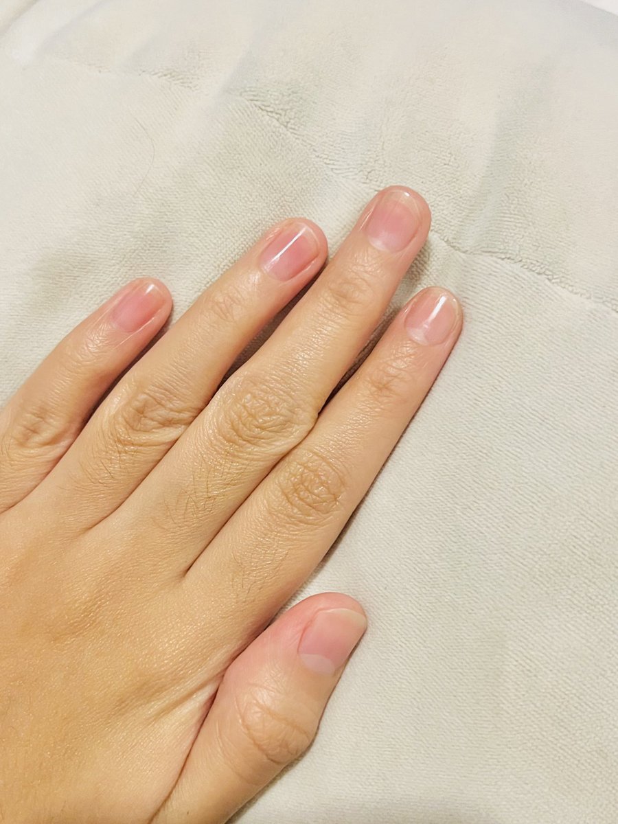 Who would’ve thought I could change my nails from this 👈🏻 to this 👉🏻? First thing first, you need to stop biting your nails sayang. 

Second, create hands &amp; nails routine. Meh I share 2 products I use + (also extra tools). Yes this is a thread on penjagaan tangan ⬇️