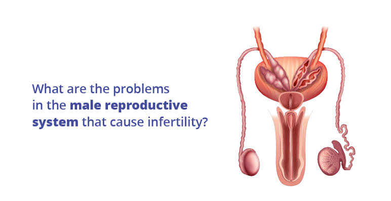 itsheathline's tweet image. What happens if a man&apos;s reproductive system doesn&apos;t work during pregnancy?
If a man&apos;s reproductive system is not working during pregnancy, it would not directly affect the pregnancy itself.  #pregnancy #malereproductivesystem