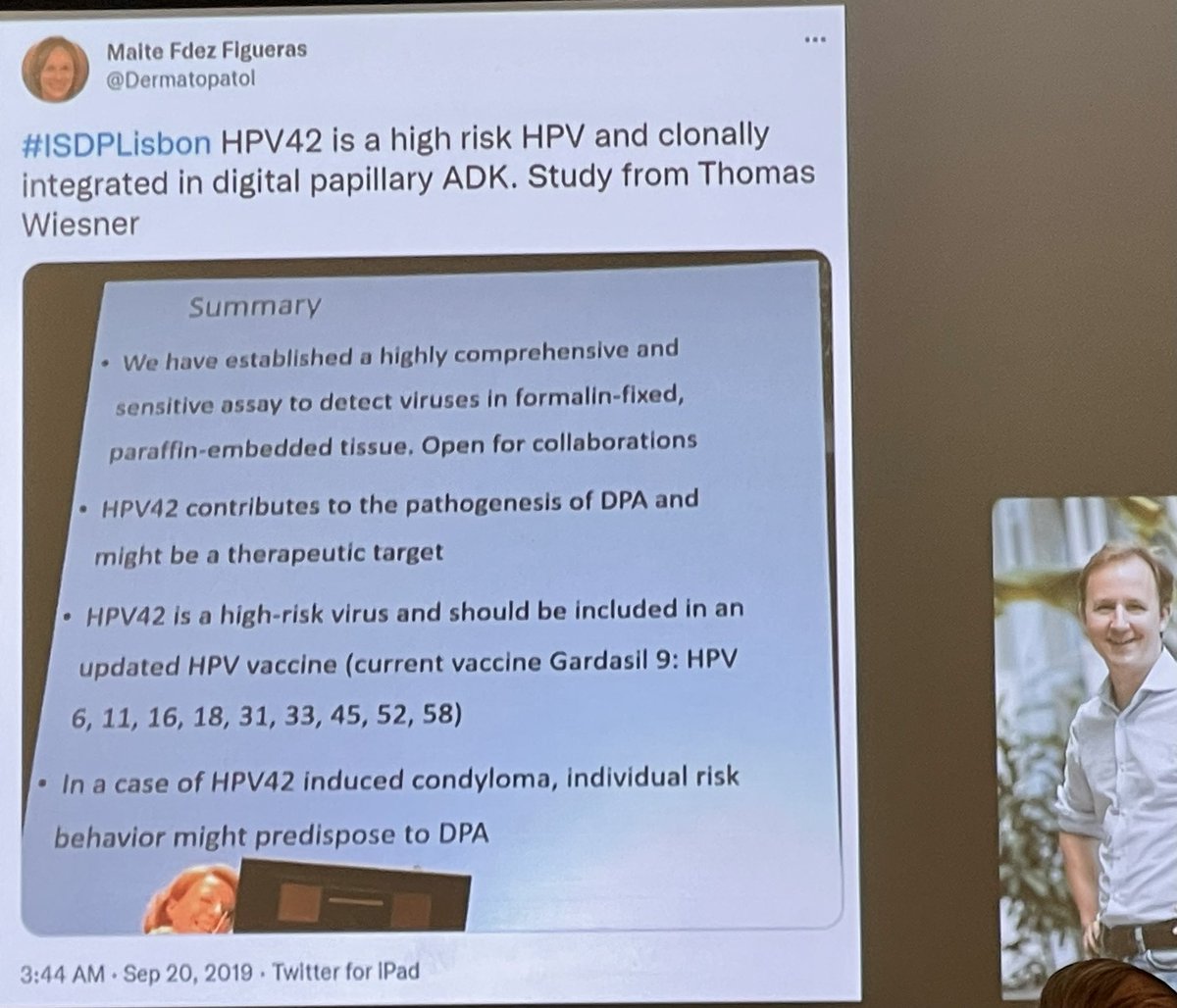 HPV42 in not only high risk condyloma but also digital papillary adenocarcinoma. Though I missed following twitt I got to catch up at AAD.😆 #dermpath