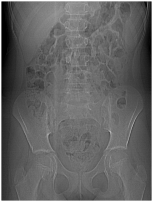mskteachingroom's tweet photo. What is this "do-not-touch" lesion? 

#radfellow #radiologyfellow #radiologyresident #learningradiology #radres #mskrad #radtwitter #radiology #transformingradiology #mri https://t.co/HY4xxTY9Kd