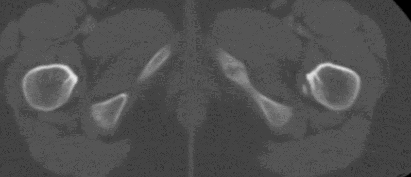 mskteachingroom's tweet photo. What is this "do-not-touch" lesion? 

#radfellow #radiologyfellow #radiologyresident #learningradiology #radres #mskrad #radtwitter #radiology #transformingradiology #mri https://t.co/HY4xxTY9Kd