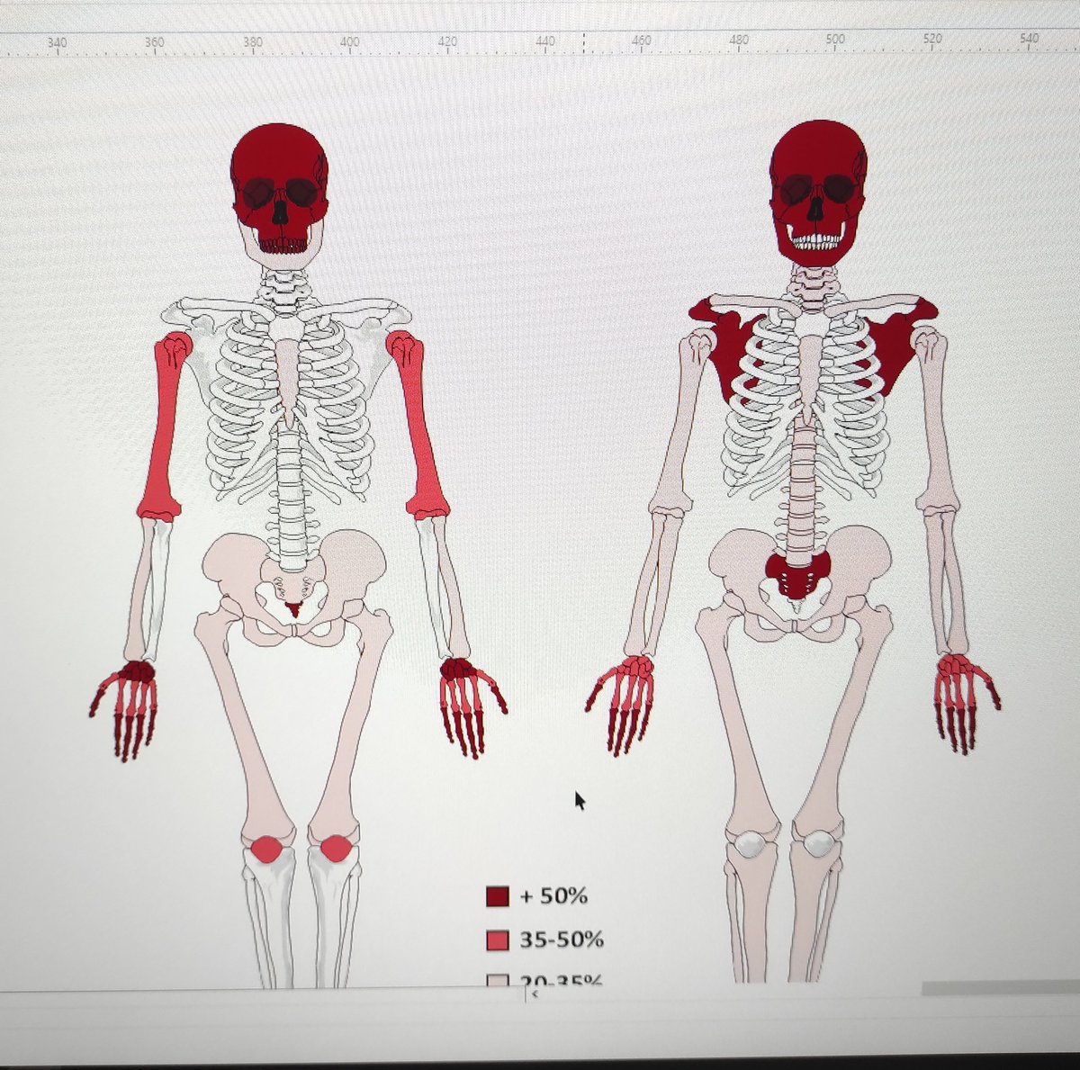 Miguel_preh's tweet image. Same vibes: 😂
#Osteology #Skeleton  #ForensicTaphonomy 💀