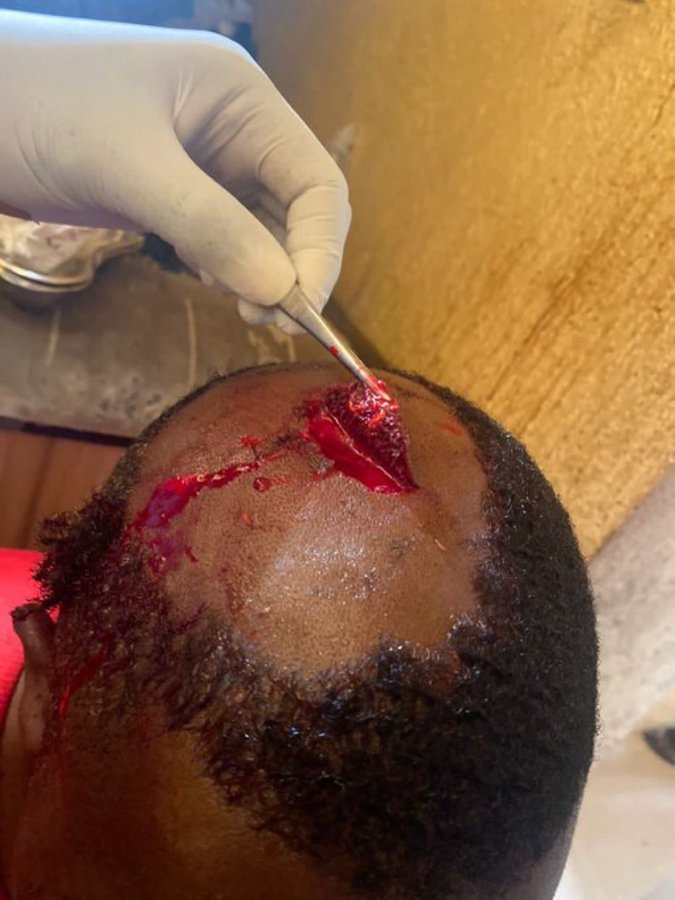 JeffreyGuterman's tweet photo. To @nimaelbagir, @CNN, @cnni: Please cover Nigerian elections marred by violence by @OfficialAPCNg (blocked me) &amp; so-called president-elect @officialABAT (blocked me). Biden et al. wrongly congratulated Tinubu. See victims of violence in replies to first tweet in thread. DM open. https://t.co/yhHhV7A8dZ