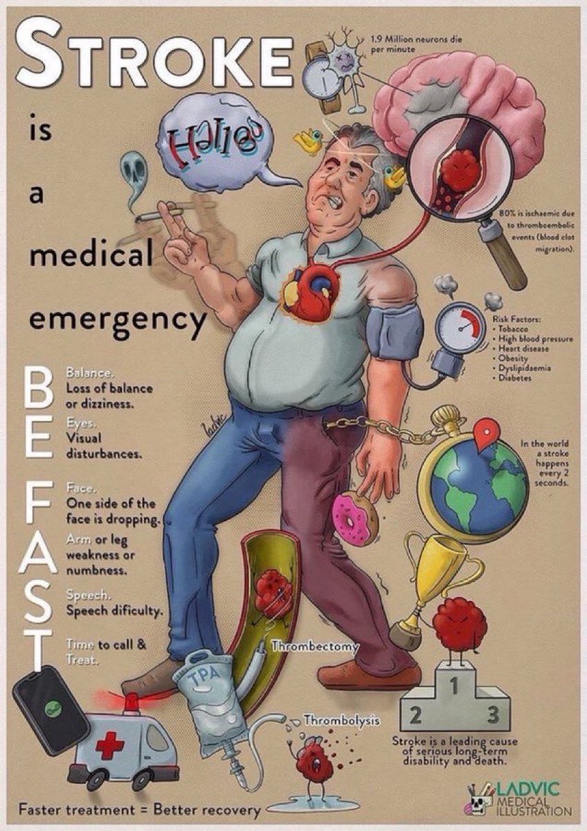 BrownJHM's tweet photo. Stroke: BE FAST #Medtwitter #medstudents https://t.co/32g5DHhtx4