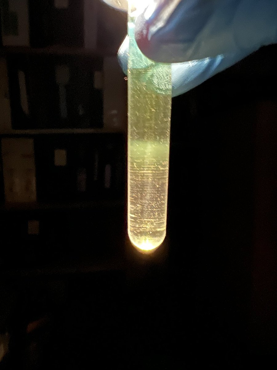 DrPrasanthM's tweet photo. And it continues… #phage #densitygradient #phagehunt https://t.co/GUdjw4RWfj