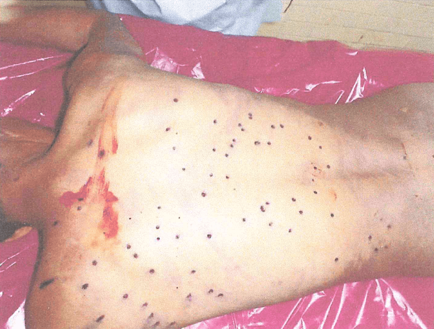 🔴 #DDHH | La necropsia de Gabriel Omar López Amanqui, uno de los fallecidos en las recientes protestas en Perú, encontró 72 orificios en el cuerpo, provocados por “esferas metálicas". Estas le destrozaron el tórax, los pulmones y el corazón.

👉 bit.ly/3ToJ6LX