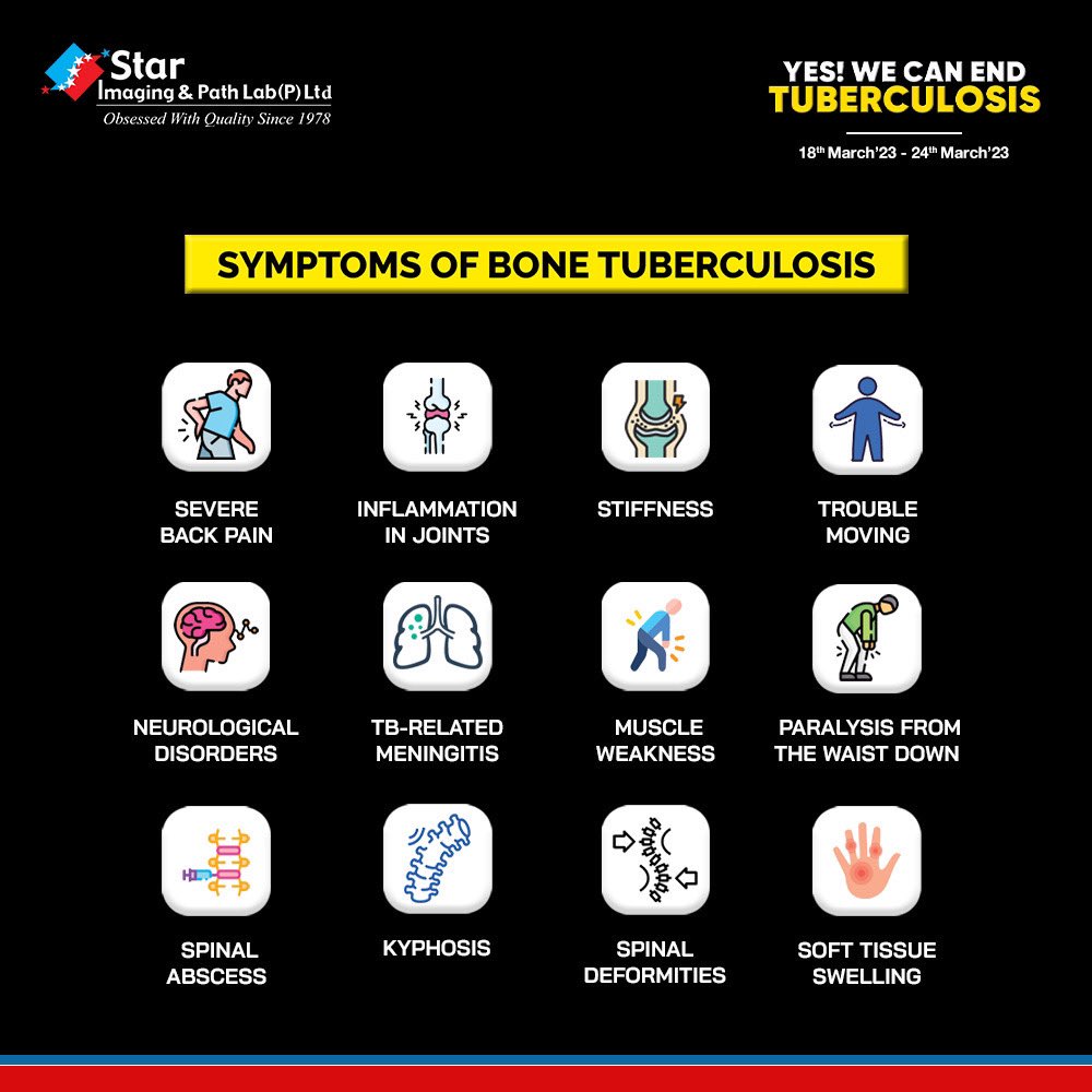 🔬 Don't let bone tuberculosis sneak up on you! 🦴 Know the symptoms, protect your health 💪 Get tested at Star Imaging and Path Lab 🌟 

#BoneTBawareness #StarImaging #PathLab #HealthMatters #BoneTuberculosis #TBsymptoms #GetTested #StarImagingLab #PathLabHeroes #HealthCheck