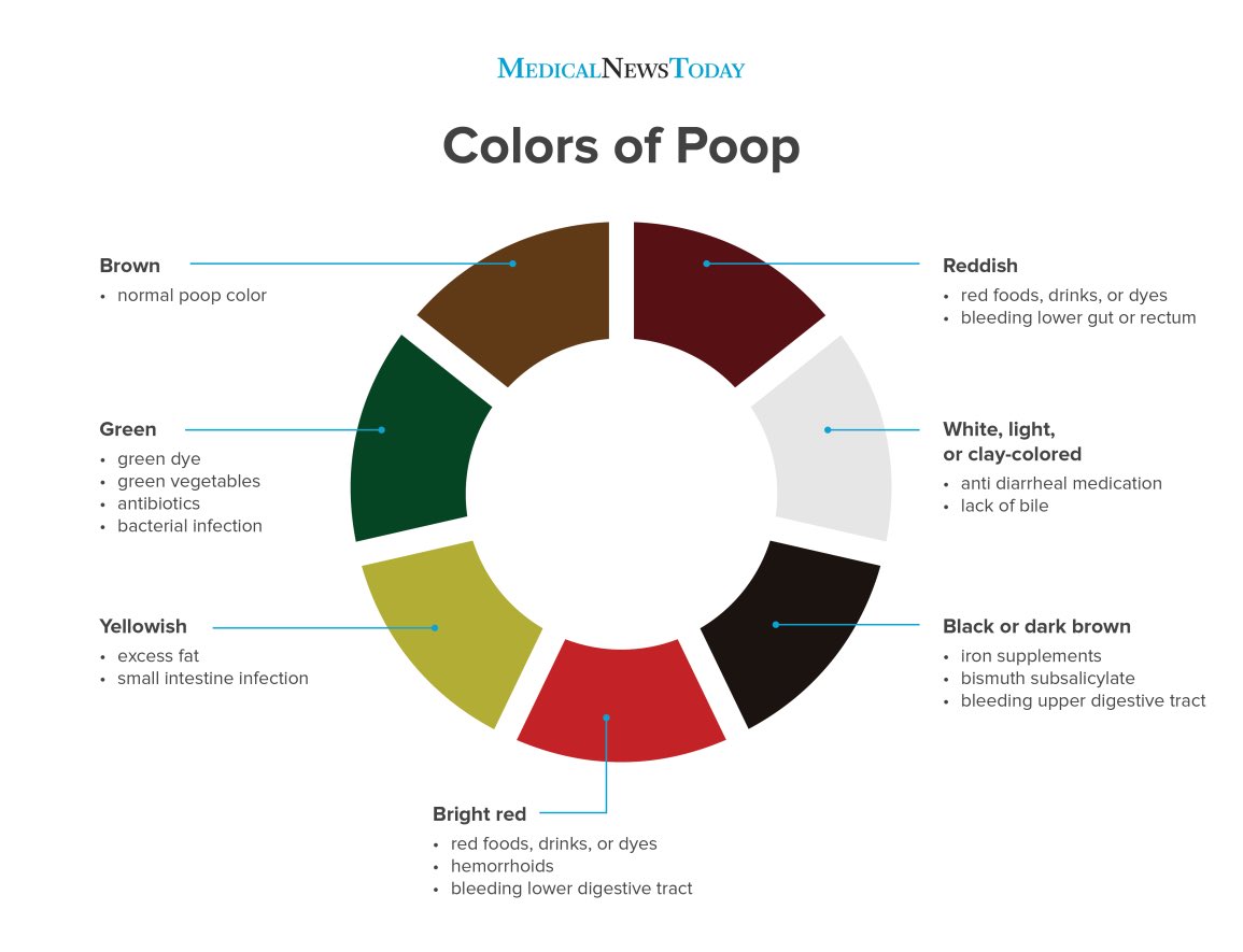 Other causes of silver stools exist. These include: biliary / pancreatic obstruction, pica, silver / heavy metal ingestion, medications (eg loperamide, bismuth), and even coeliac disease. Thank you for keeping an open mind.

Here’s a stool colour chart for reference.