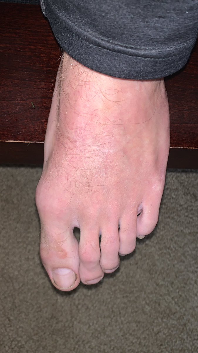 MasterJames80's tweet image. Scums #feet #feetfinder #feetpicsforsales #feetfetiche #femboy #findom #findomdom