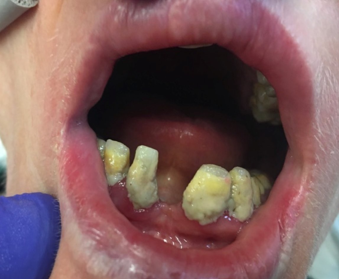 MCM_HEKSS's tweet photo. #wohd Firstly KNOWLEDGE, for example, what are the consequences of not cleaning mouths and dentures? https://t.co/KNorIWvzjU