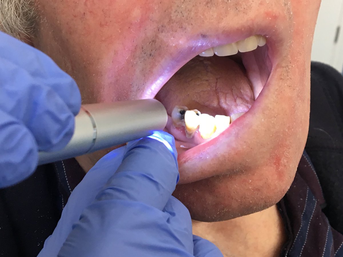 MCM_HEKSS's tweet photo. #WOHD2023 Seondly, SKILLS - #mouthcare is a practical skill. Do all health care professionals feel confident in providing mouthcare, for example, for people with may resist mouth care? https://t.co/pnKCSpu1Hx