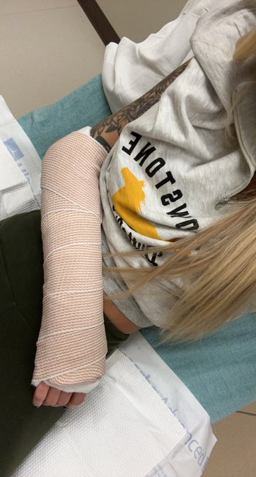 My fricken luck. 🫤 It&rsquo;s broke but no surgery needed. https://t.co/39M7xMao2W<a href="/tag/onlyfans"class="tags"><span>#onlyfans</span></a>