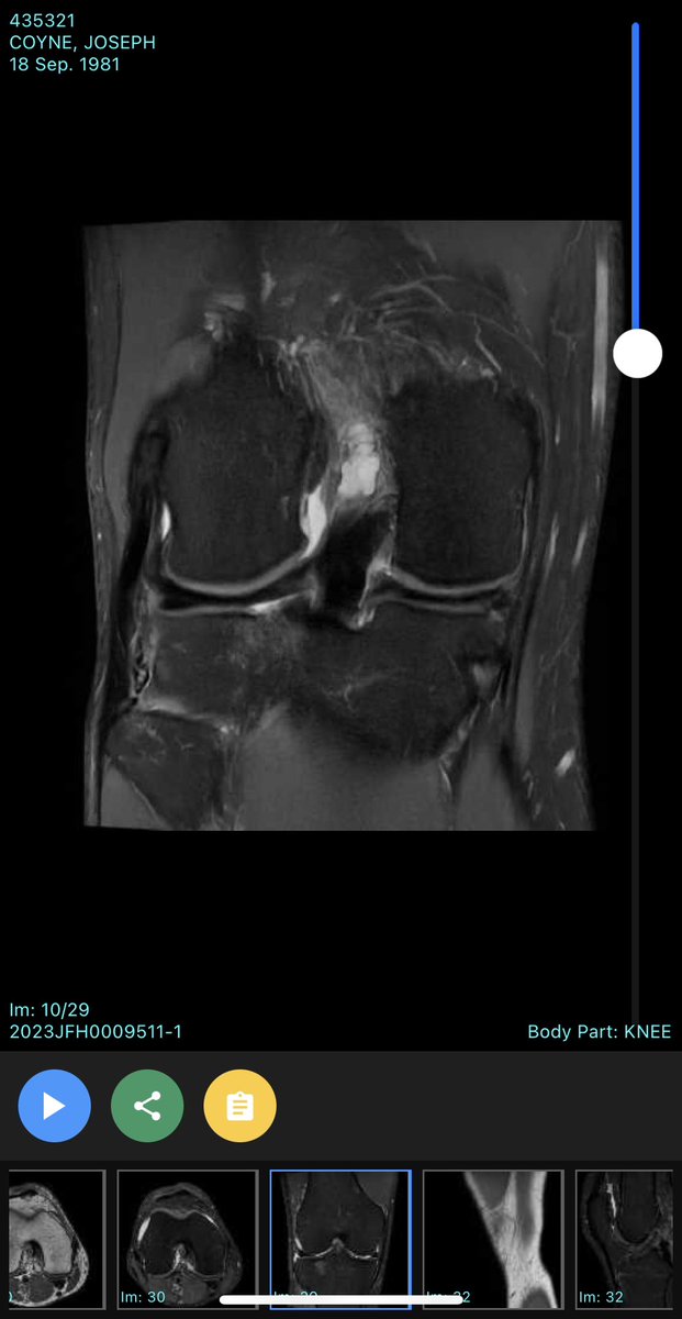 Joseph Coyne, PhD tweet media