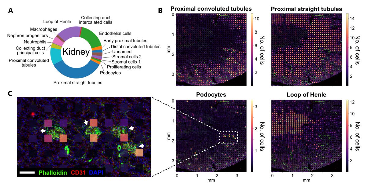johwirth's tweet photo. Finally we showed that #xDBiT is compatible with state-of-the-art analysis tools like #MEFISTO or #cell2location to gain more detailed information on the structure of the multidimensional datasets. For this, the #kidney was used as model organ. 5/6 https://t.co/JaMk4ayrv9