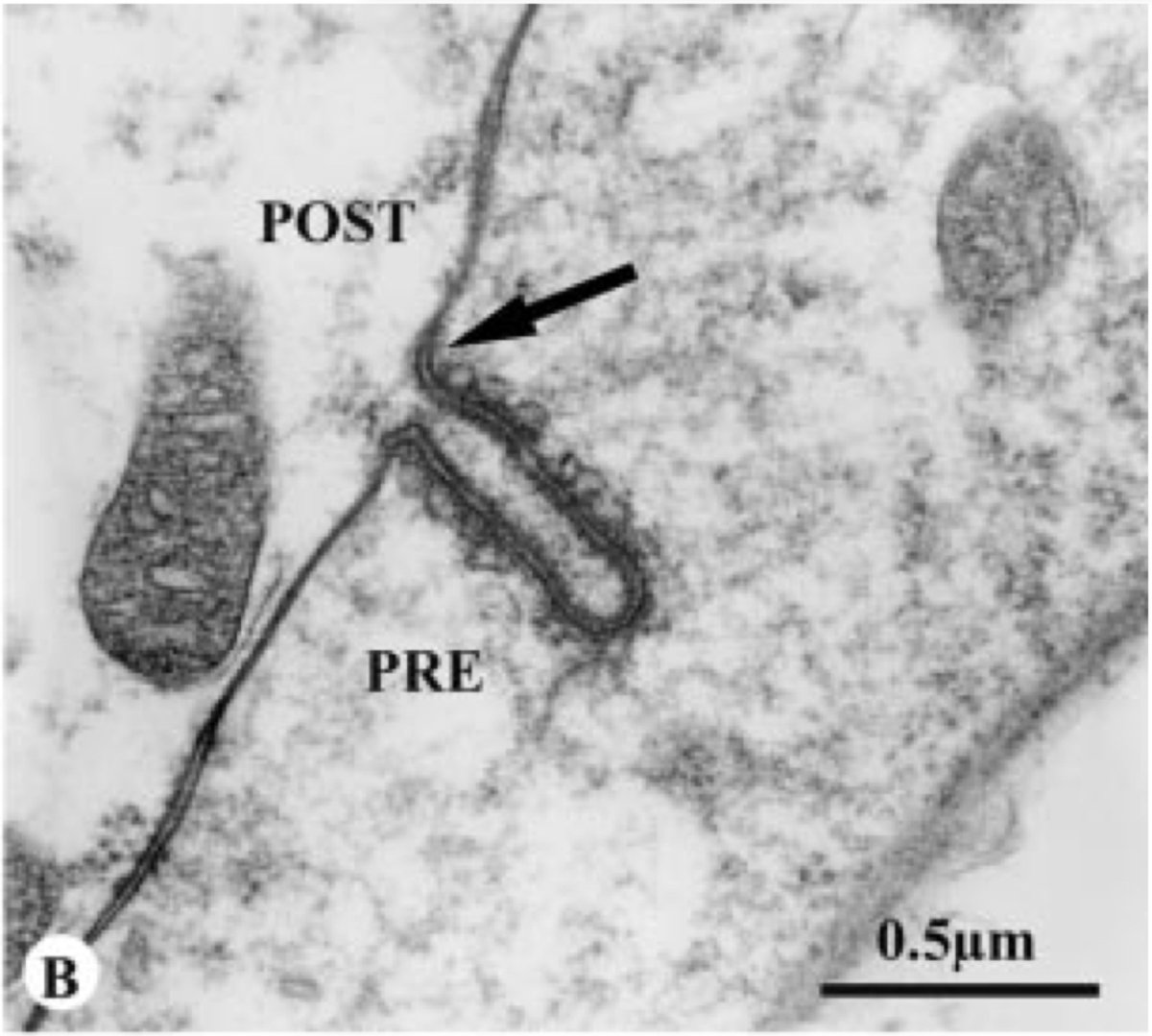 HaniehFalahati's tweet image. A Nowruz special of #EM_Monday!I will share what I have found about the evolution of dendritic spine. The earliest thing I found distantly resembling a spine is in the retina of box jellyfish, which shows an invagination of postsynapse into presynapse (doi.org/10.1086/bblv21…)1/n