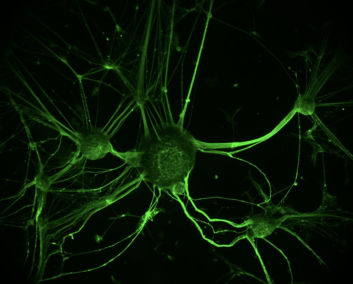 BRCHFX's tweet photo. Neuroscience as Art Auction closes at midnight tonight. Get your bids in via the form on the website https://t.co/XkSeGhCjiq or email brainrepair@dal.ca - all proceeds to the IWK Eye Clinic. @IWKHealth @NSHealthHub  @DalhousieU @PsychNeuroDal @DalNeuro @RafuseVictor @AIneurolab https://t.co/U2ISJWRjw2