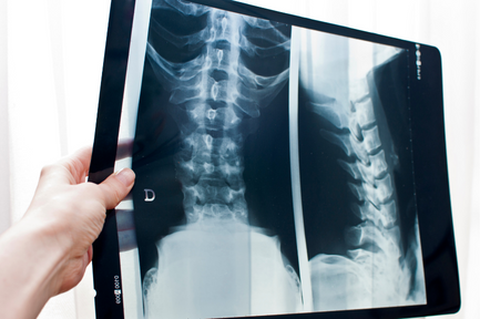 NUHDREEAM's tweet photo. Confused about X-Rays and how to interpret them – or even discuss them? We have just what you need 👇
https://t.co/mhA1glt8V6
#DREEAM #education #elearning #educationispower #healthcareprofessionals #healthcareheroes #healthcarecareers #learningandevelopment @TeamNUH https://t.co/4zzExz3k7K