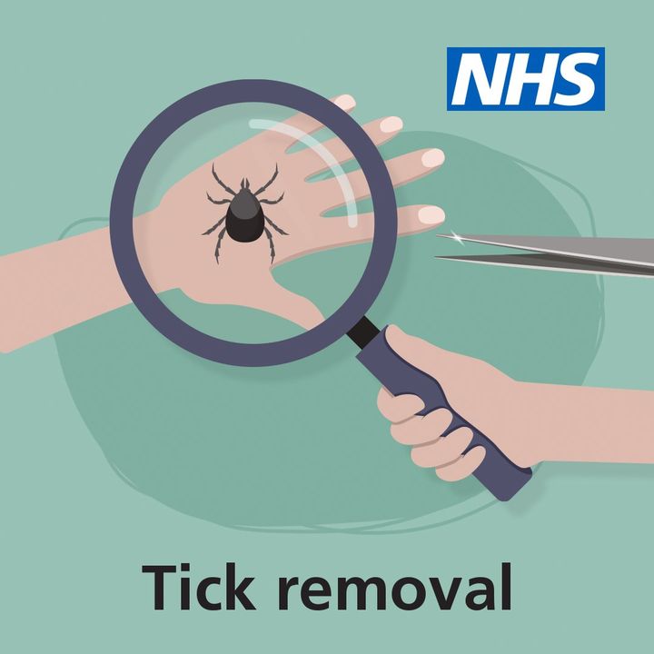 It's #TickBitePreventionWeek - do you know how to spot and remove a tick? 

Not all ticks in England carry the bacteria that causes Lyme disease. But it's still important to #BeTickAware and safely remove them as soon as possible, just in case.

➡️ nhs.uk/conditions/lym…