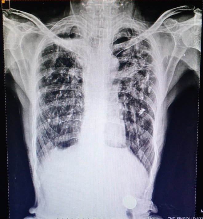 dr_itesh's tweet image. Diagnosis??