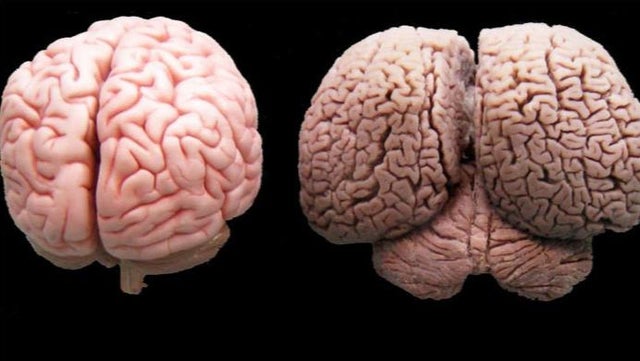 CienciaDelCope's tweet image. Cerebro humano vs. Cerebro de delfín