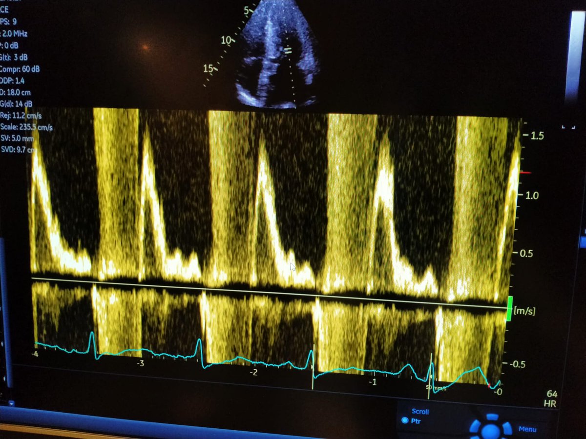 Sabha Bhatti MD tweet media