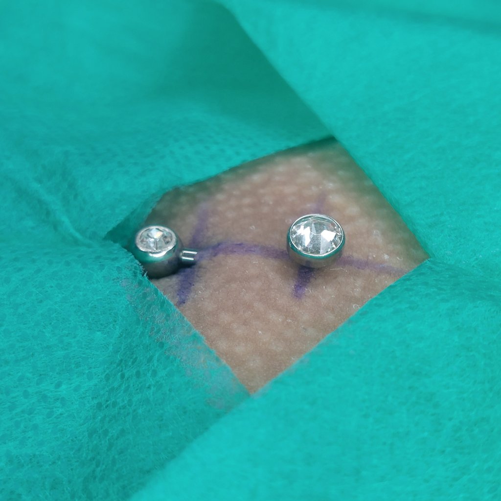 Lizzy_piercer's tweet photo. Christina piercing 💕🔞
Piercing genital/íntimo 
Feito com jóia L-bar em titânio ASTM, com 2 zircônias 
Piercing seguro 🌟🤘 https://t.co/MZMS3JpPL8