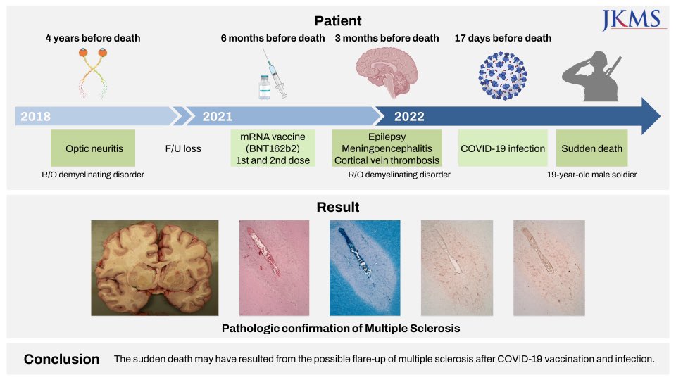 COVID VACCINE INJURIES on Twitter "“Sudden Death Associated With
