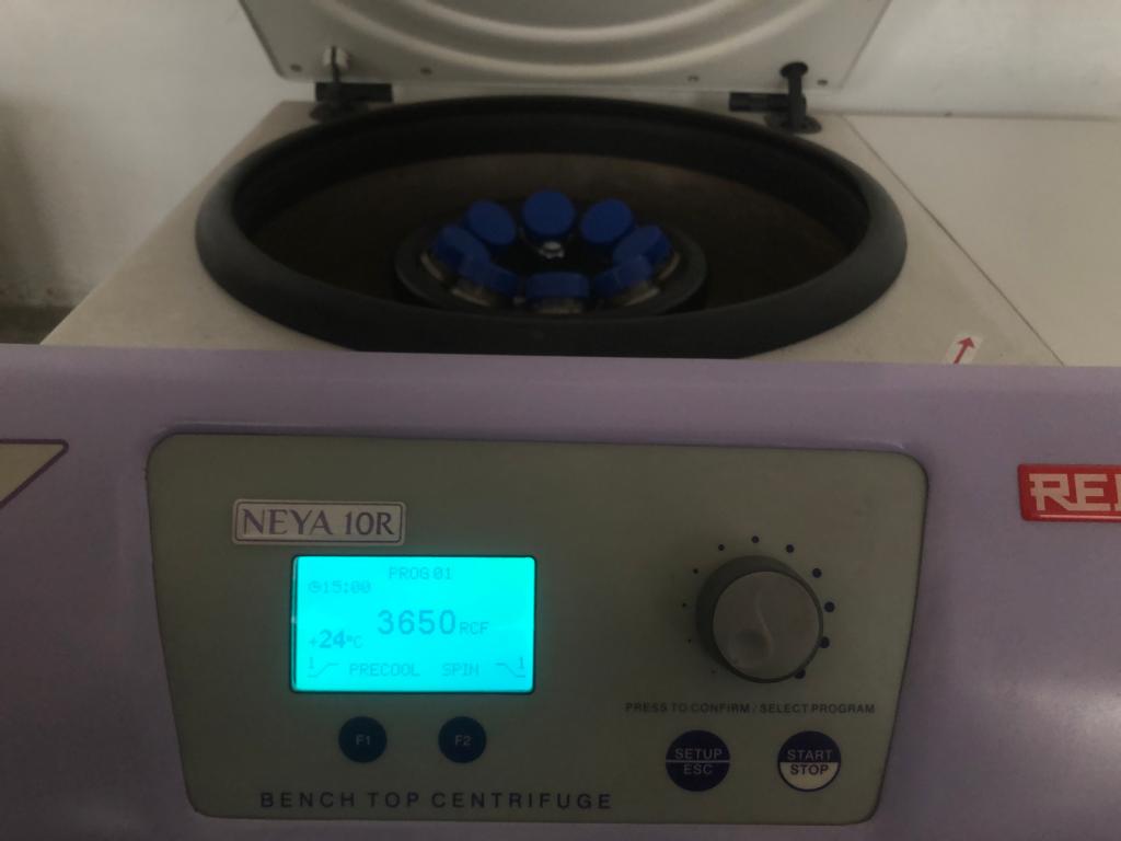 Sachida_Pokhrel's tweet photo. Resting spores extraction of Plasmodiophora brassicae from the club root of cabbage.
#clubroot #soilbornepathogens #plantpathology #research https://t.co/NjywVw7Qat