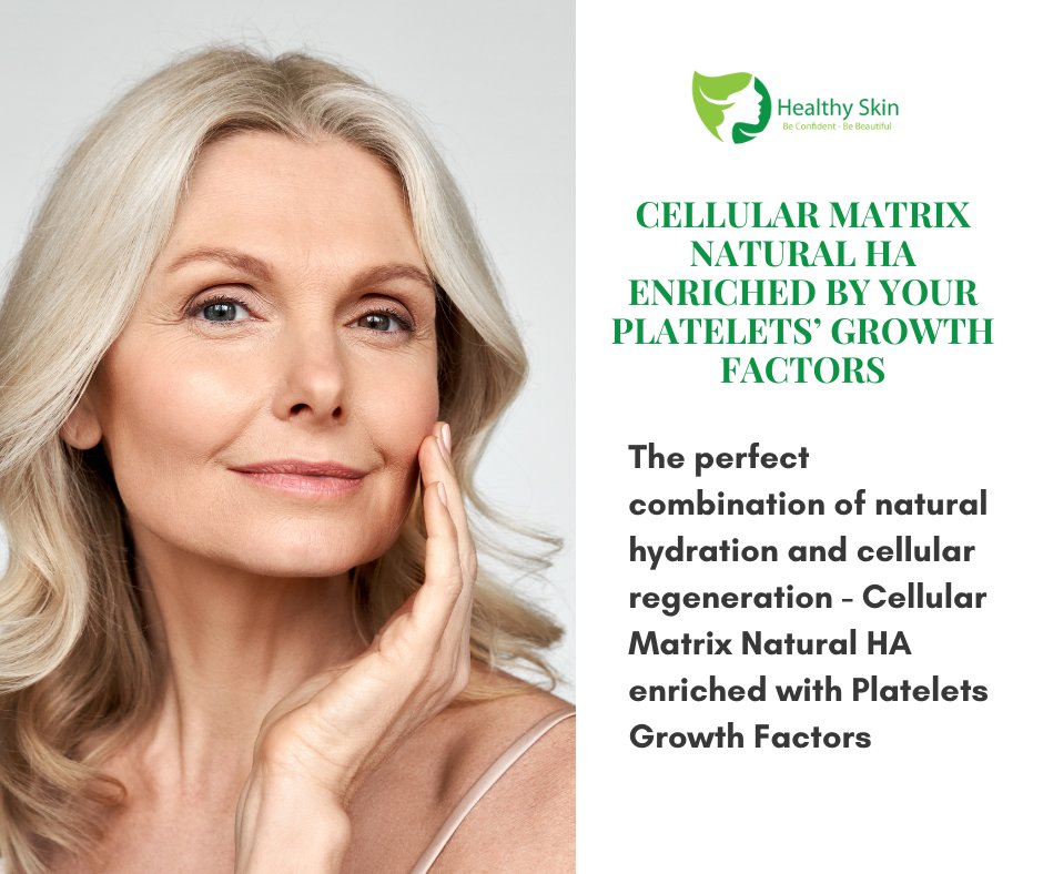 HealthySkinHKT's tweet image. Revitalize the look of your skin with ✨ Cellular Matrix Natural HA Enriched by your platelets&apos; growth factors. Book your appointment NOW! 📌  

Learn more here 👉 buff.ly/3ltHwvG

#CellularMatrix #NaturalHA #SkinTreatment #Collagen #SkinCare