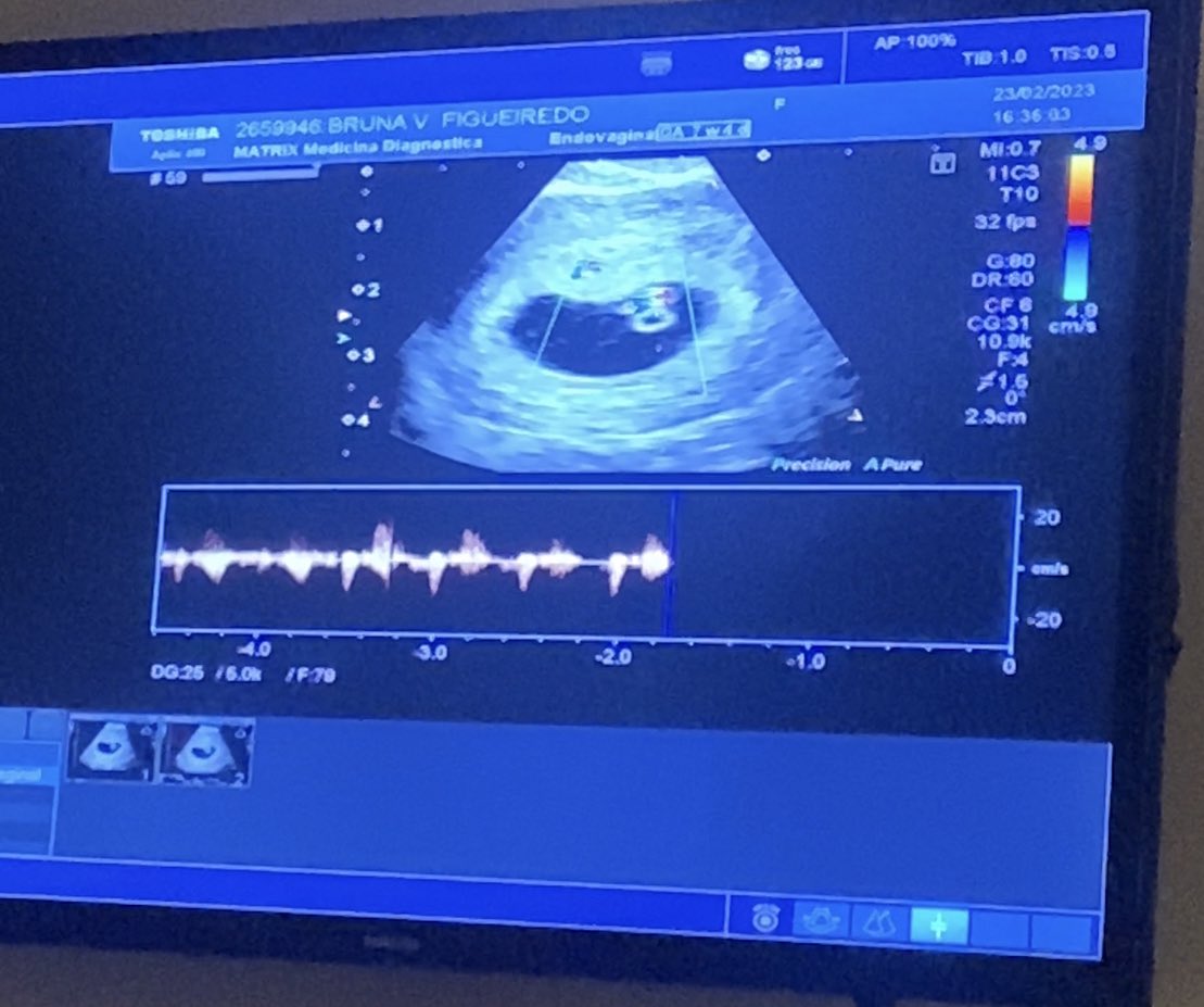 buvidall's tweet photo. eu, médica, conduzi diversos atendimentos de planejando familiar

e não fui capaz

de planejar meu próprio planejamento https://t.co/0pkbvbZ5fU