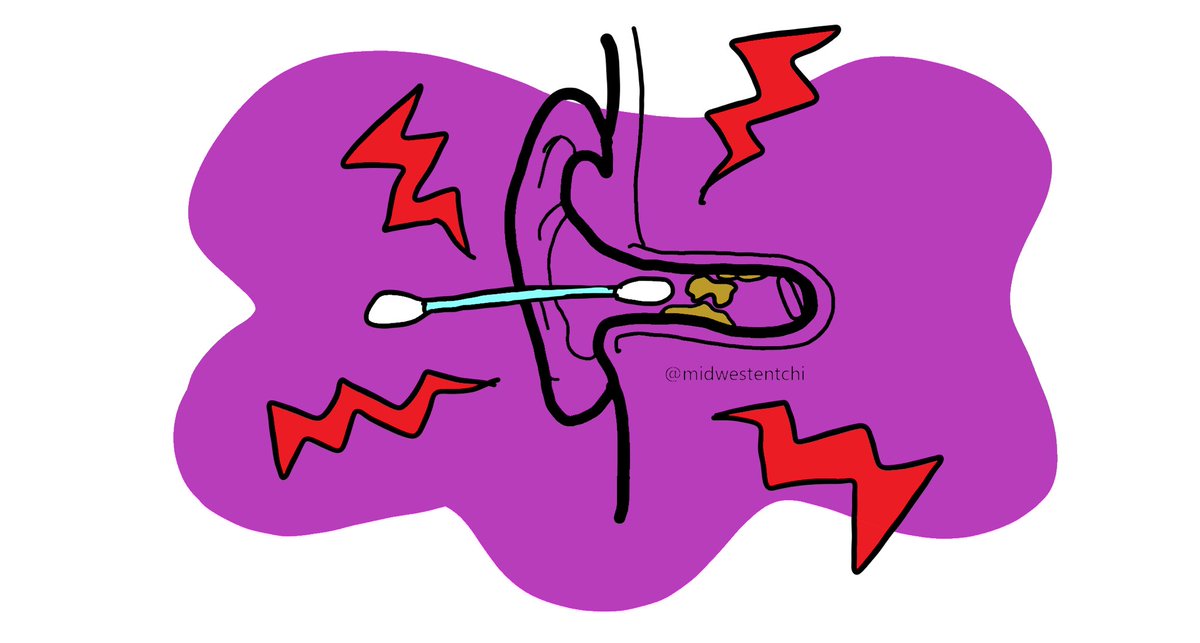 ⚠️Did you know q-tips can dry out the ear canal and push wax further into the ear canal?⚠️It is recommended to refrain from using q-tips to clean your ears!

#hearingloss #hearinglossawareness #audiology #audiologists #audiologist #ent #midwestent #midwestentchi