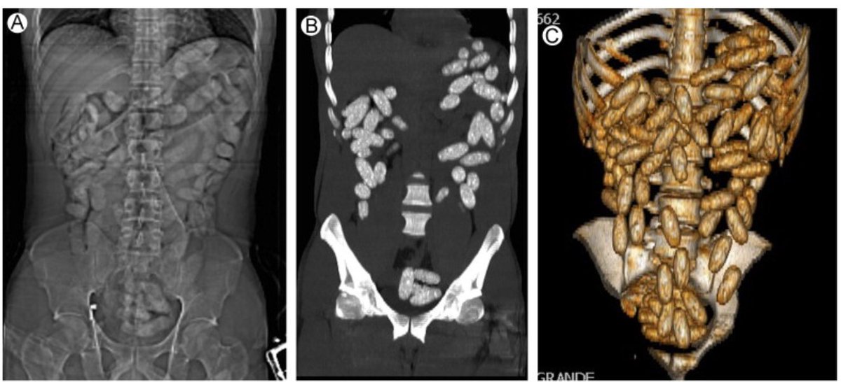 OGdukeneurosurg's tweet photo. Tell me about this problem, please. https://t.co/lcoaXFS1WC