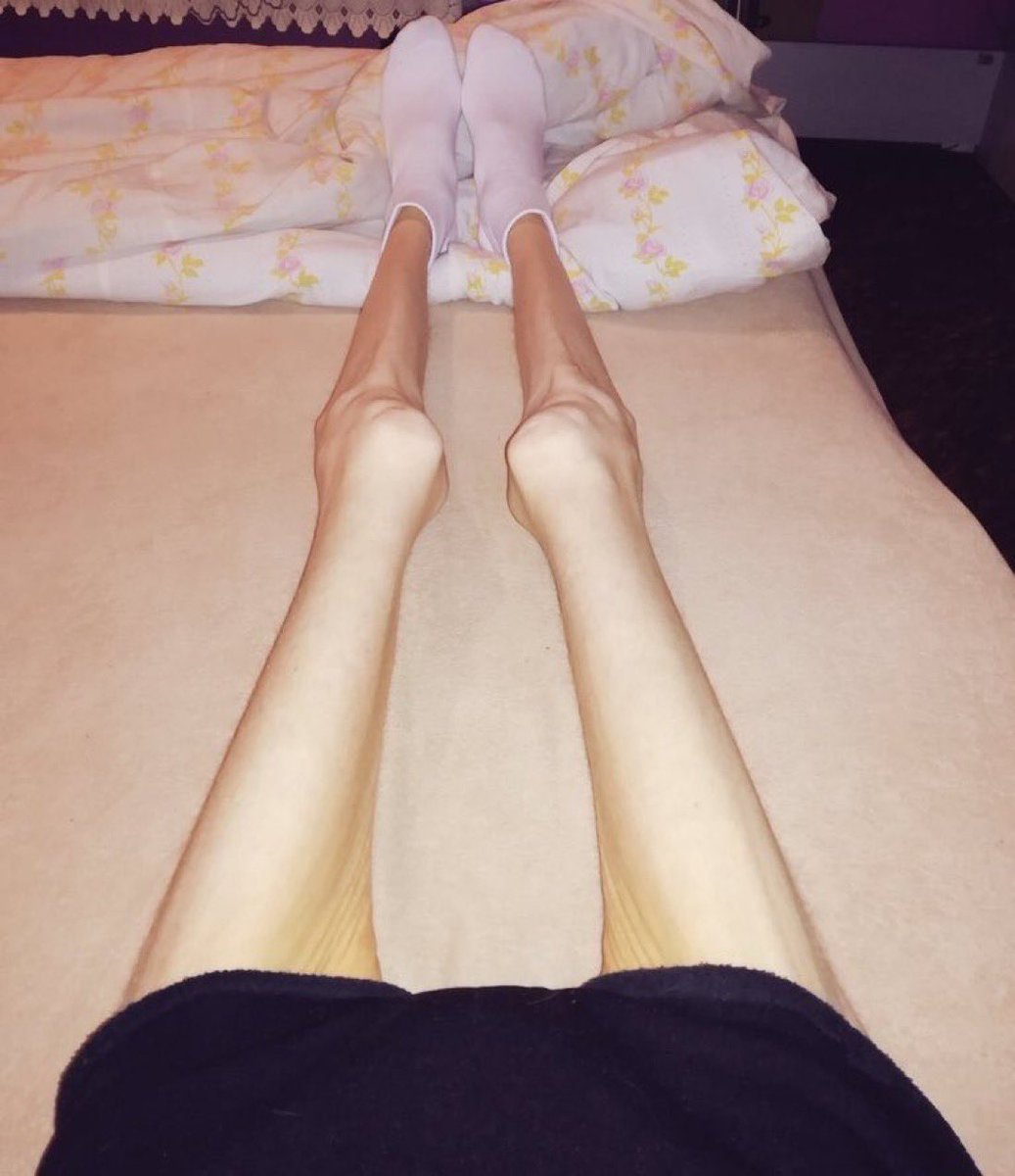 VoidHigh's tweet photo. ✧･ﾟ: *✧･ﾟ:* unpinning when im bmi 12 *:･ﾟ✧*:･ﾟ✧ https://t.co/GbBB8ZlA1f
