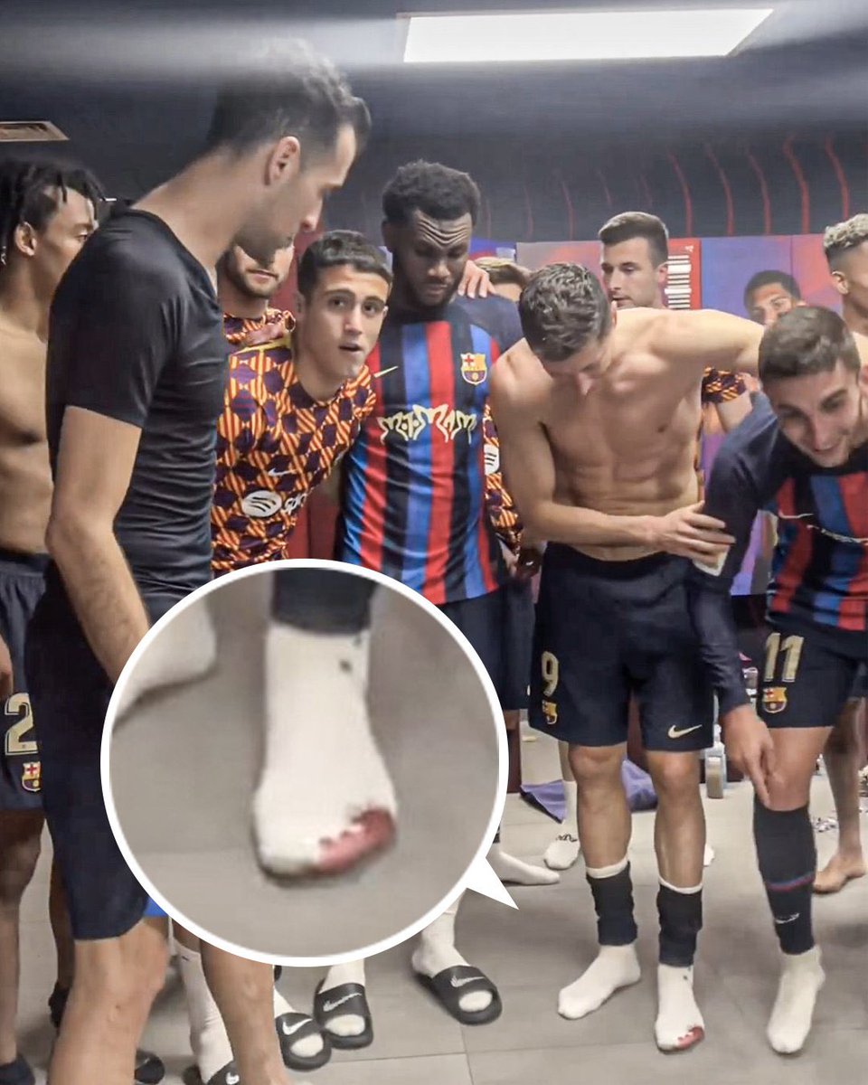 <a href="/BarcaUniversal/">Barça Universal</a> <a href="/_AdrianSnchz/">ᴀᴅʀɪᴀ́ɴ sᴀ́ɴᴄʜᴇᴢ</a> After they did this to us? Smh 🤦 they are not serious