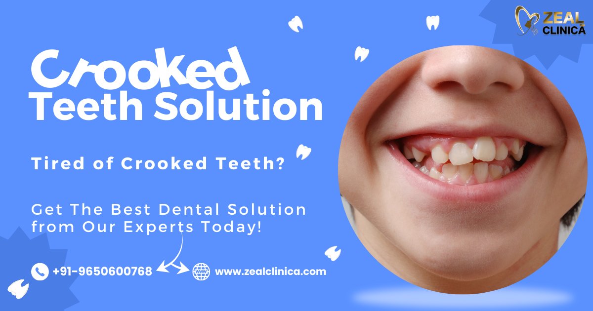 ZealClinica's tweet image. 🤔💭💭 Do you spend hours wondering about a #CrookedTeeth solution? 😬 Why not leave the hard task to the professionals? 🙌 Book an appointment with our highly skilled dentist 👨‍⚕️ and let experts take charge of the situation!

#crackedtooth #teeth #teethcare #dental #brokenteeth