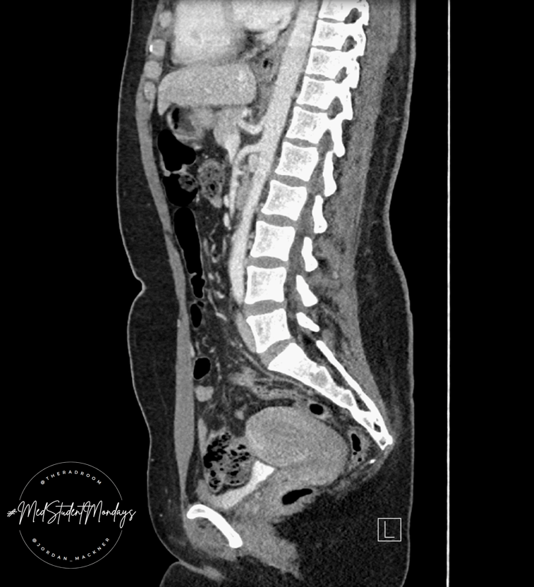 TheRadRoom's tweet photo. 🧵1/#medstudents! Sagittal reformats got you feeling down? Wish there was more #Radiology in your curriculum? Us too! We have exciting things coming with our new✨MSC✨so stick around for our first installment of #MedStudentMondays https://t.co/xO0xnjxGn8