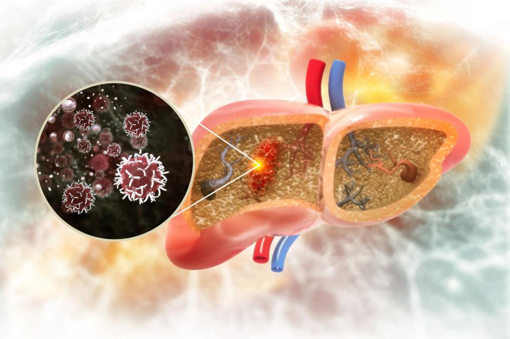 nypost's tweet photo. AI develops cancer treatment in 30 days, predicts survival rate https://t.co/X65sEEqThQ https://t.co/zSMH256DAW