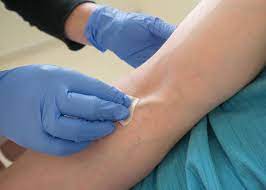 JedCalunsag's tweet photo. Aww ugat palang ulam na.

What is the superior antisepsis technique?
a. Cleanse the site in a circular manner/direction
b. Cleanse the site with back and forth friction https://t.co/lbq5MnPw9i