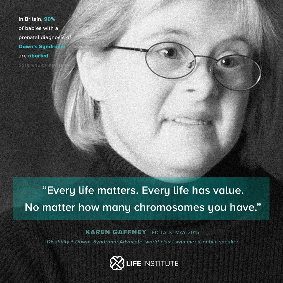 Every single person is unique and precious from the moment of conception, and all are deserving at a chance at life!

Today is World Down’s Syndrome Day, a day to remind us of this ever-important message! 

#WorldDownsSyndromeDay #WDSD23 #DontScreenUsOut #EveryLifeIsPrecious