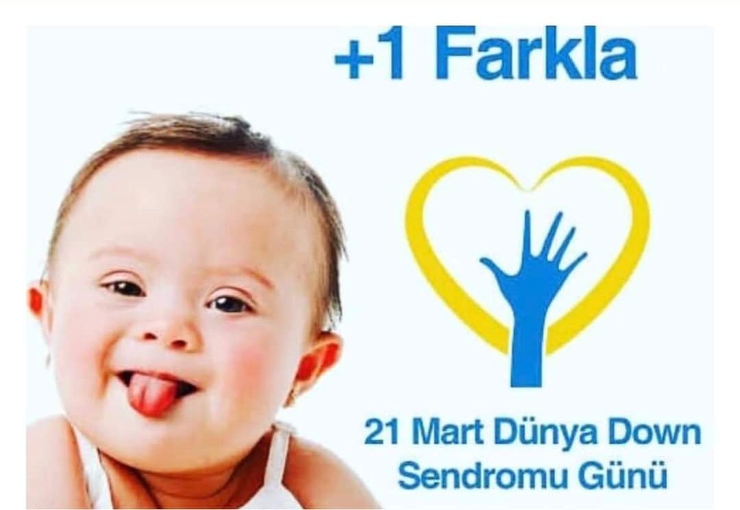 Bizden eksik değiller, fazlalar.💜
+1 farkla🙏
#DownSendromu #21MartDünyaDownSendromuFarkındalıkGünü #DownSyndrome #Trisomy21