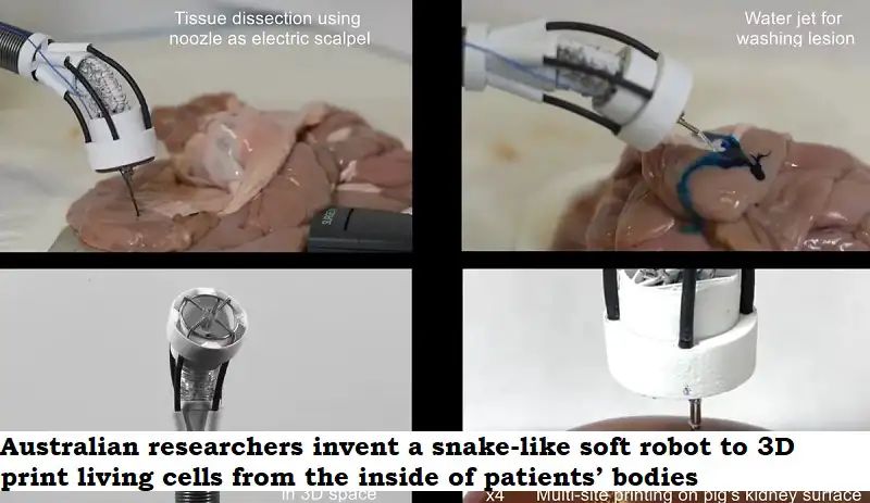 robotics4india's tweet image. Australian researchers invent a snake-like soft robot to 3D print living cells from the inside of patients&apos; bodies

#robotics #roboticsnews #ai #roboticsainews #robots #3dprinted #3dprint #news