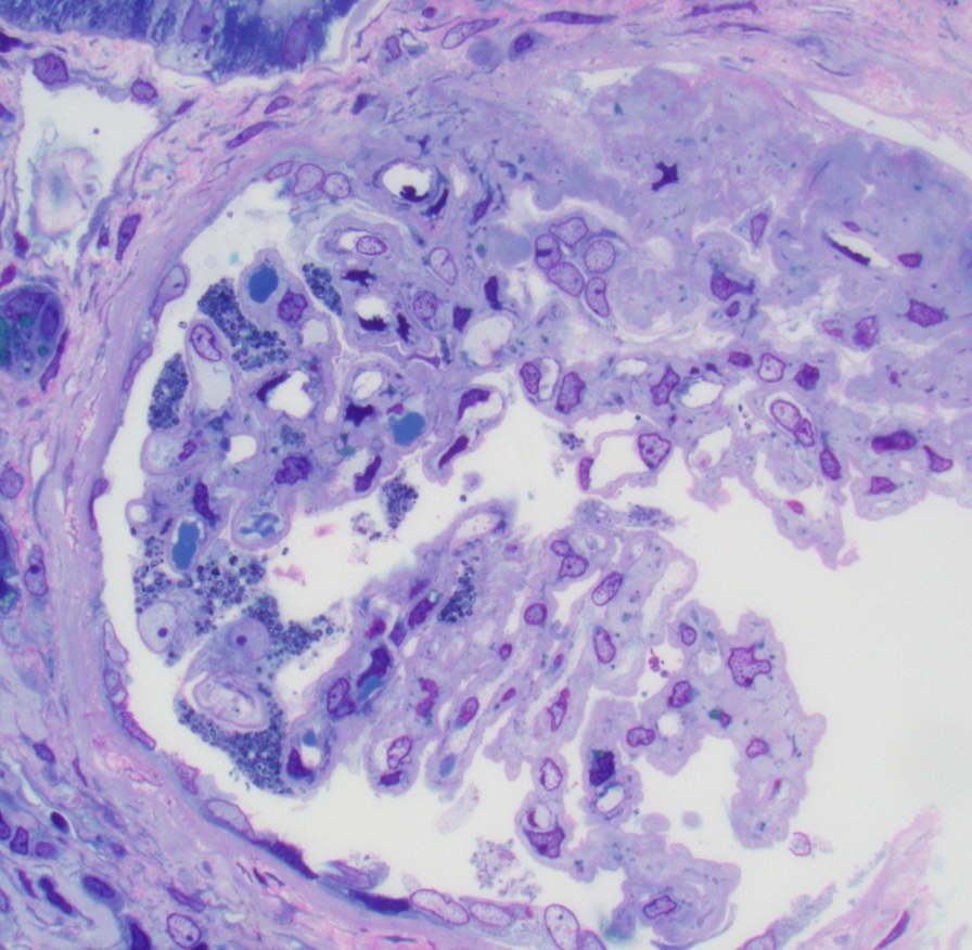 JZRenalPath tweet picture