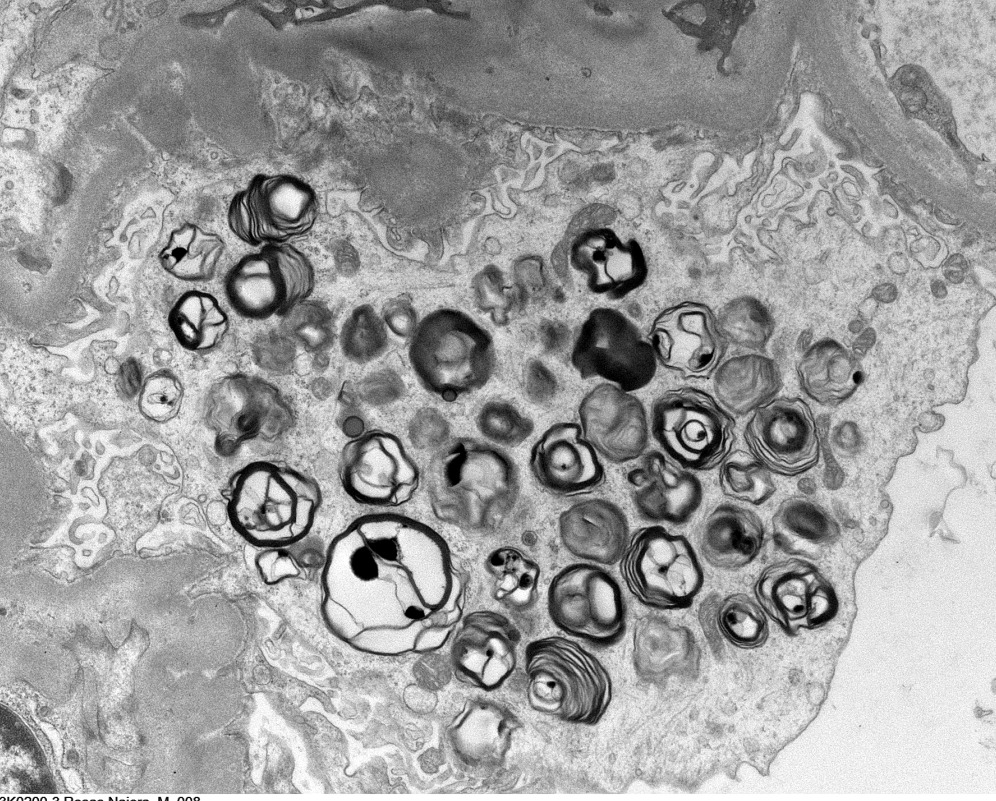 JZRenalPath tweet picture