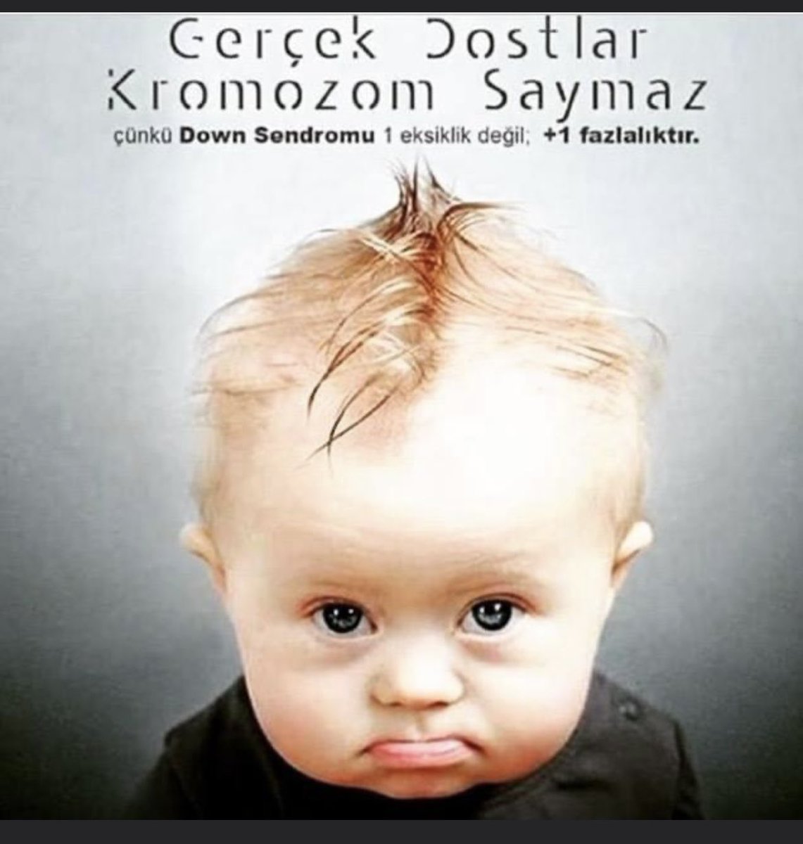 #21mart #downsendromu 
Farkına varalım, farklarımız olduğunun, farkımız olsun ❤️