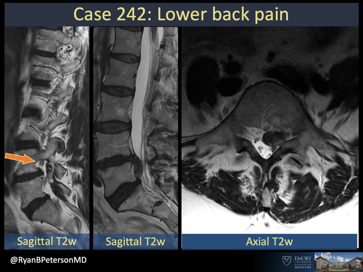 Ryan B Peterson 🇸🇪 tweet media
