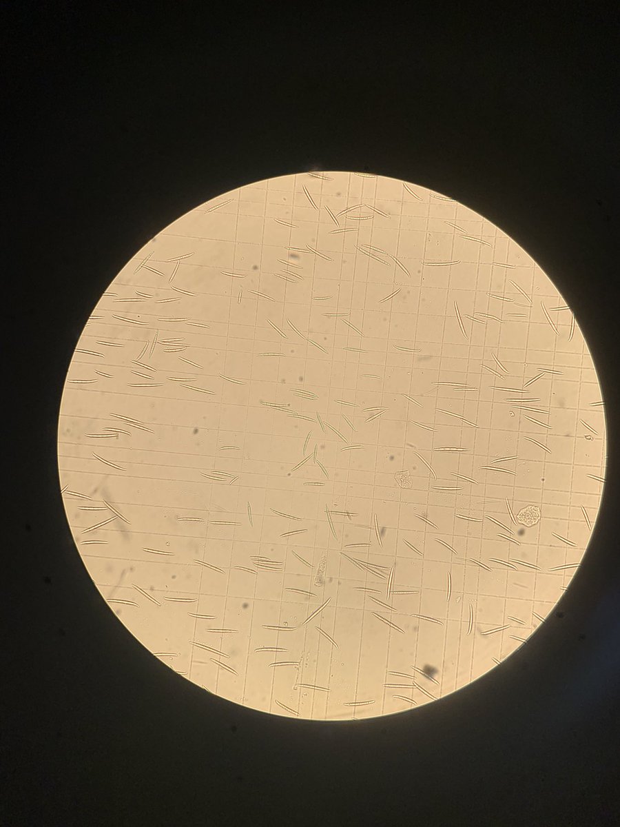 Harvesting Fusarium spores today. I am having a bit of trouble with my pellet being very loose after spinning down my liquid culture, and I fear that I am loosing quite a few spores, when I discard the supernatant. Has anyone experienced this? #fusarium #microbiology